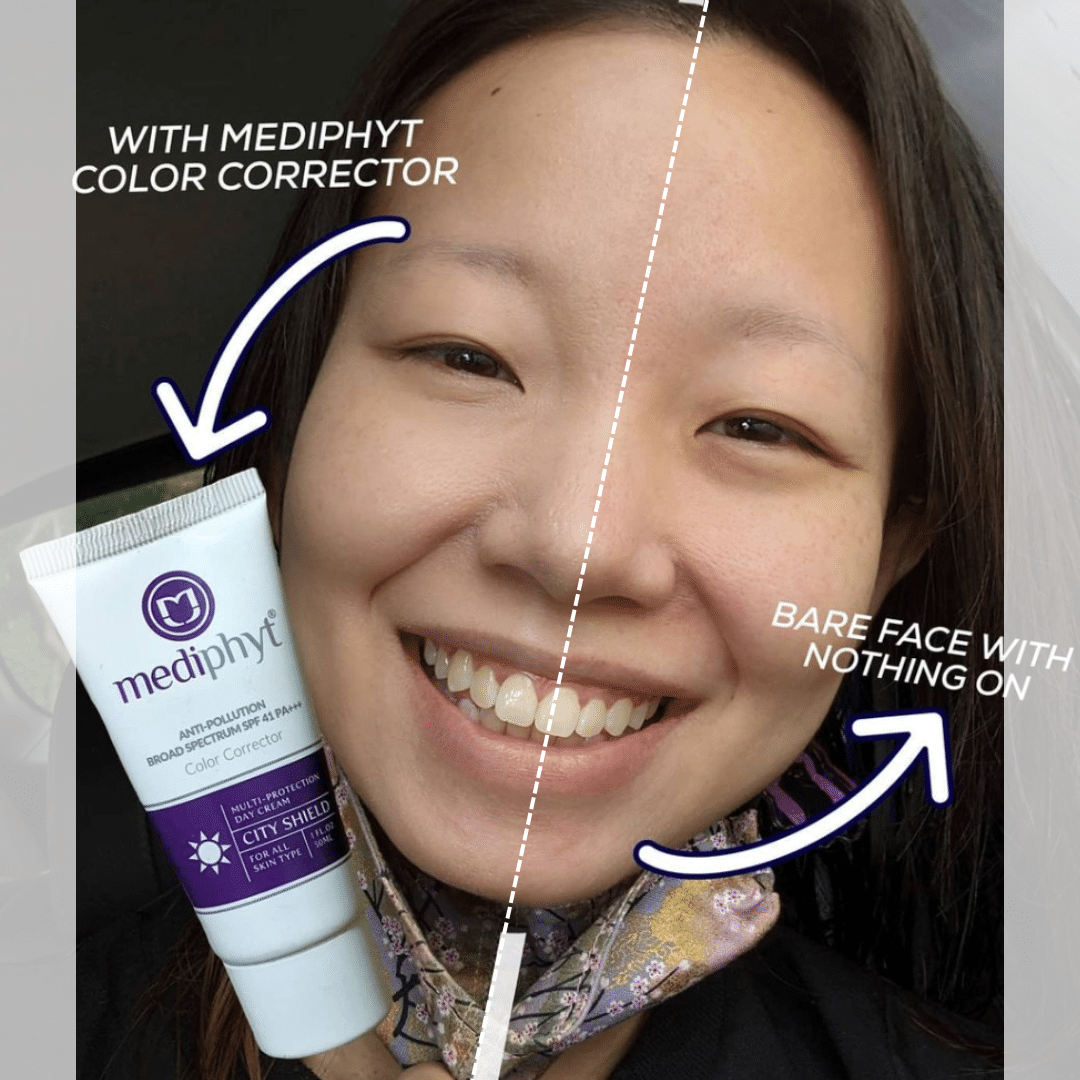 Mediphyt City Shield Customer's Review
